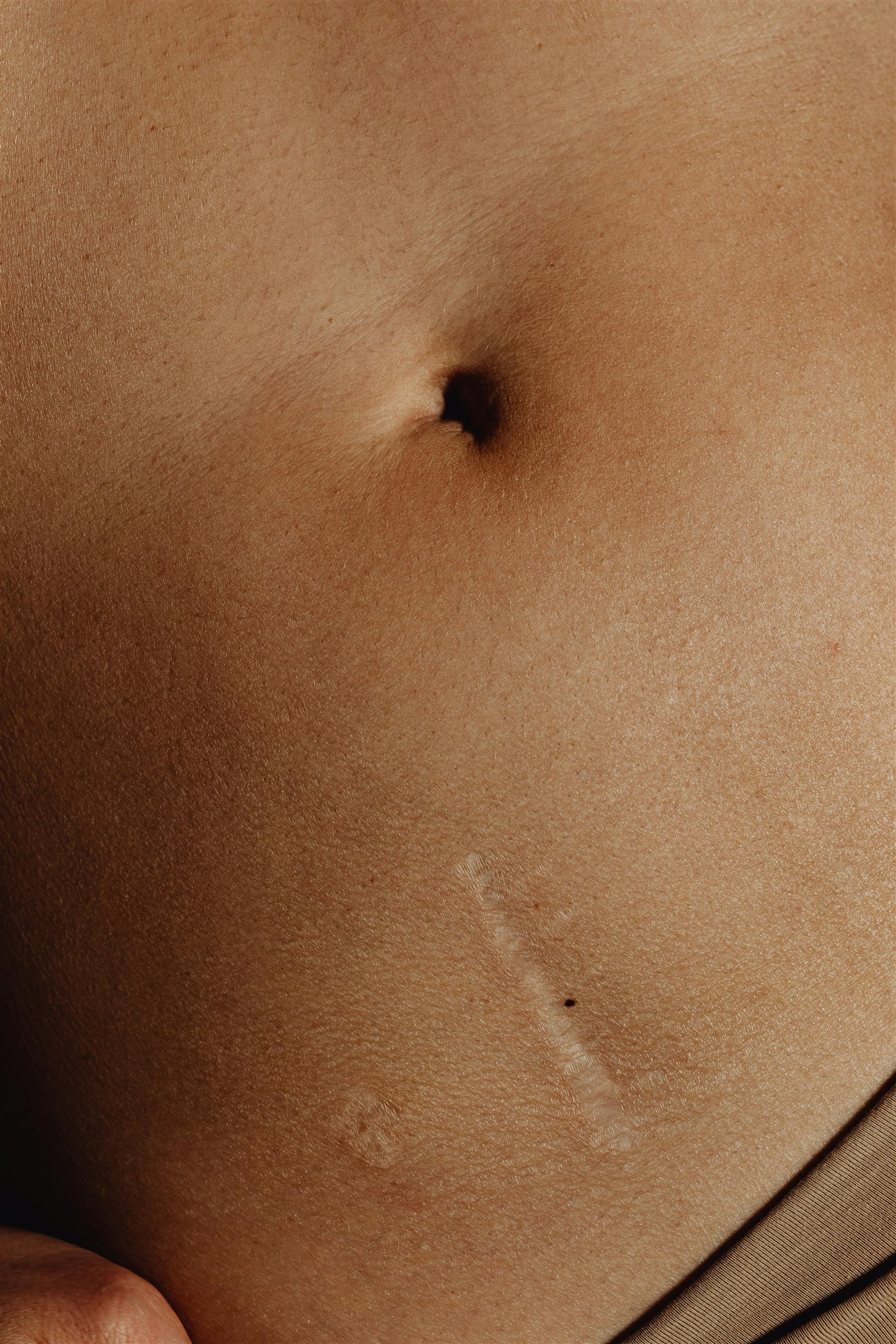 Scar Off