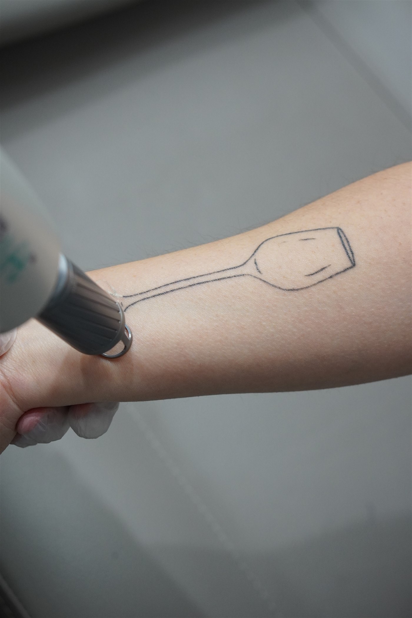 Tattoo Off